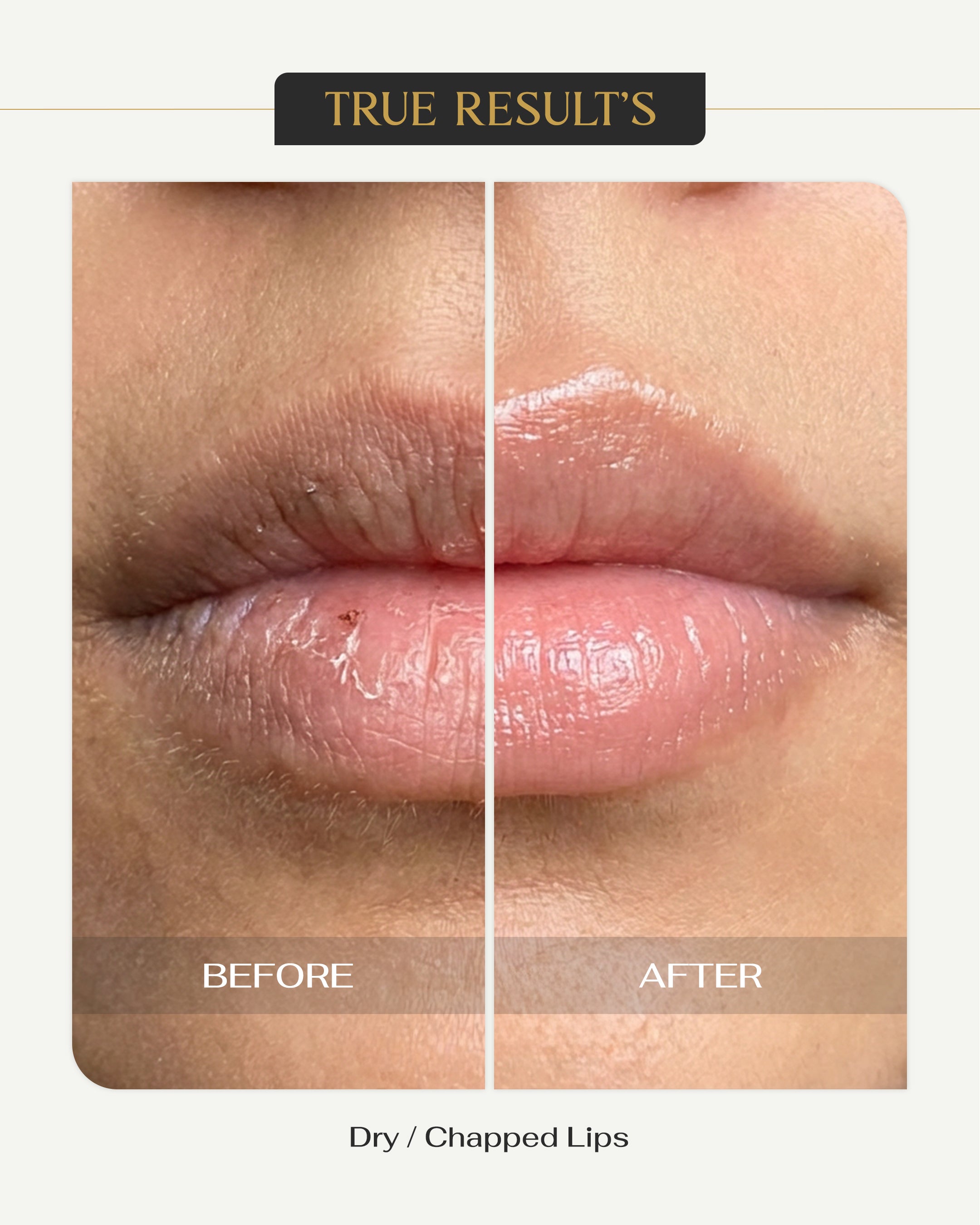 Luxe Lip Shield