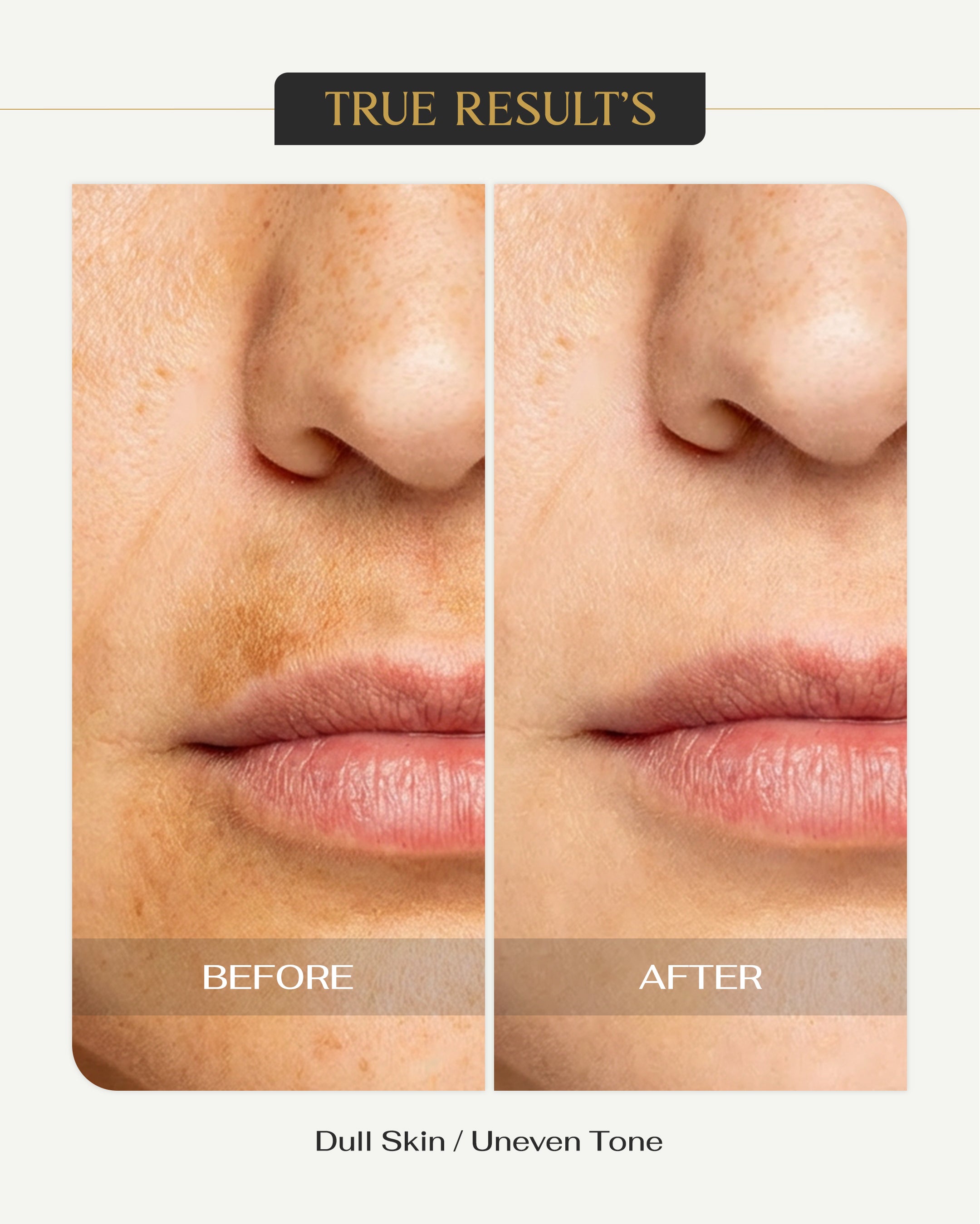 Derma C Face Serum