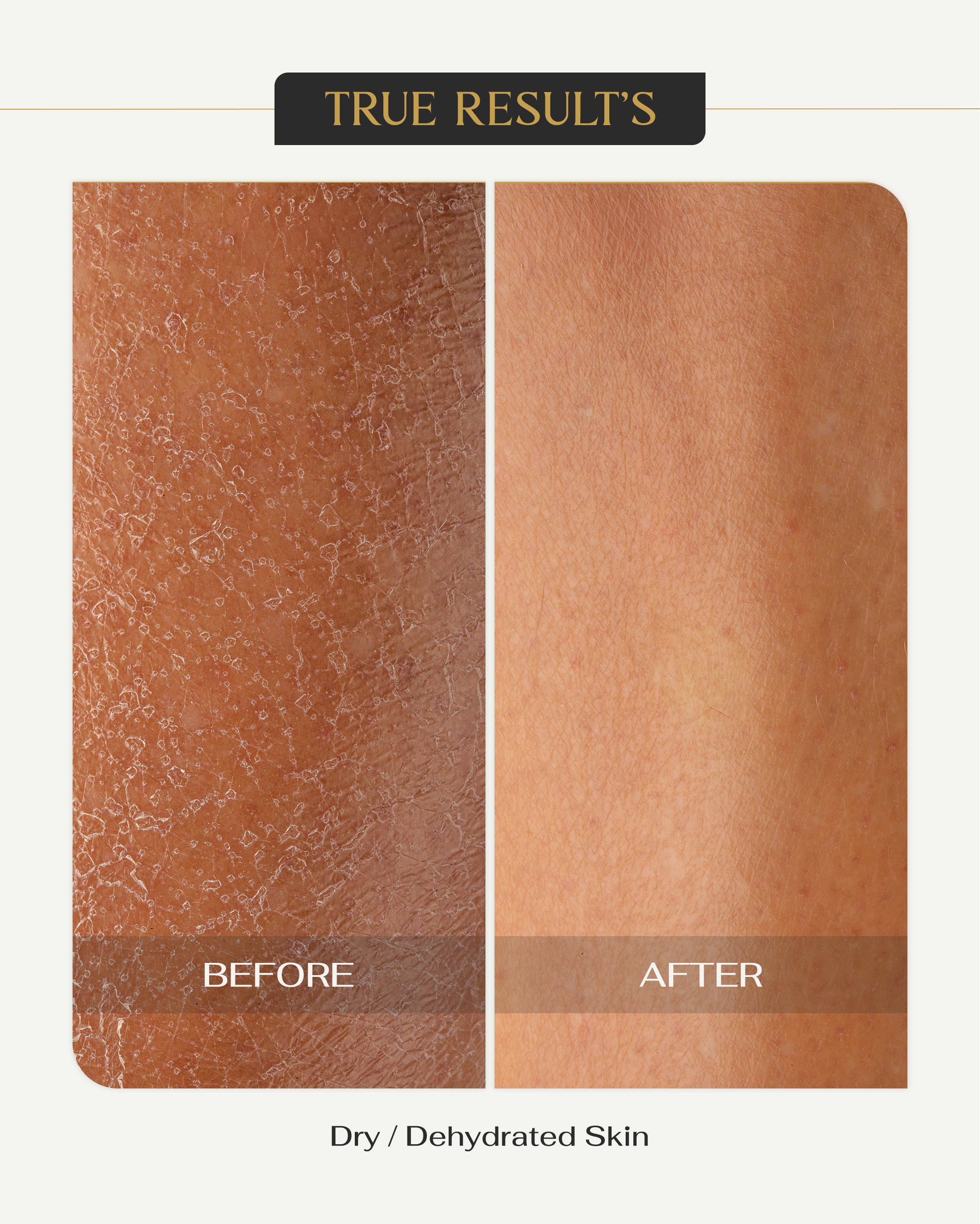 Daily Moist Cream