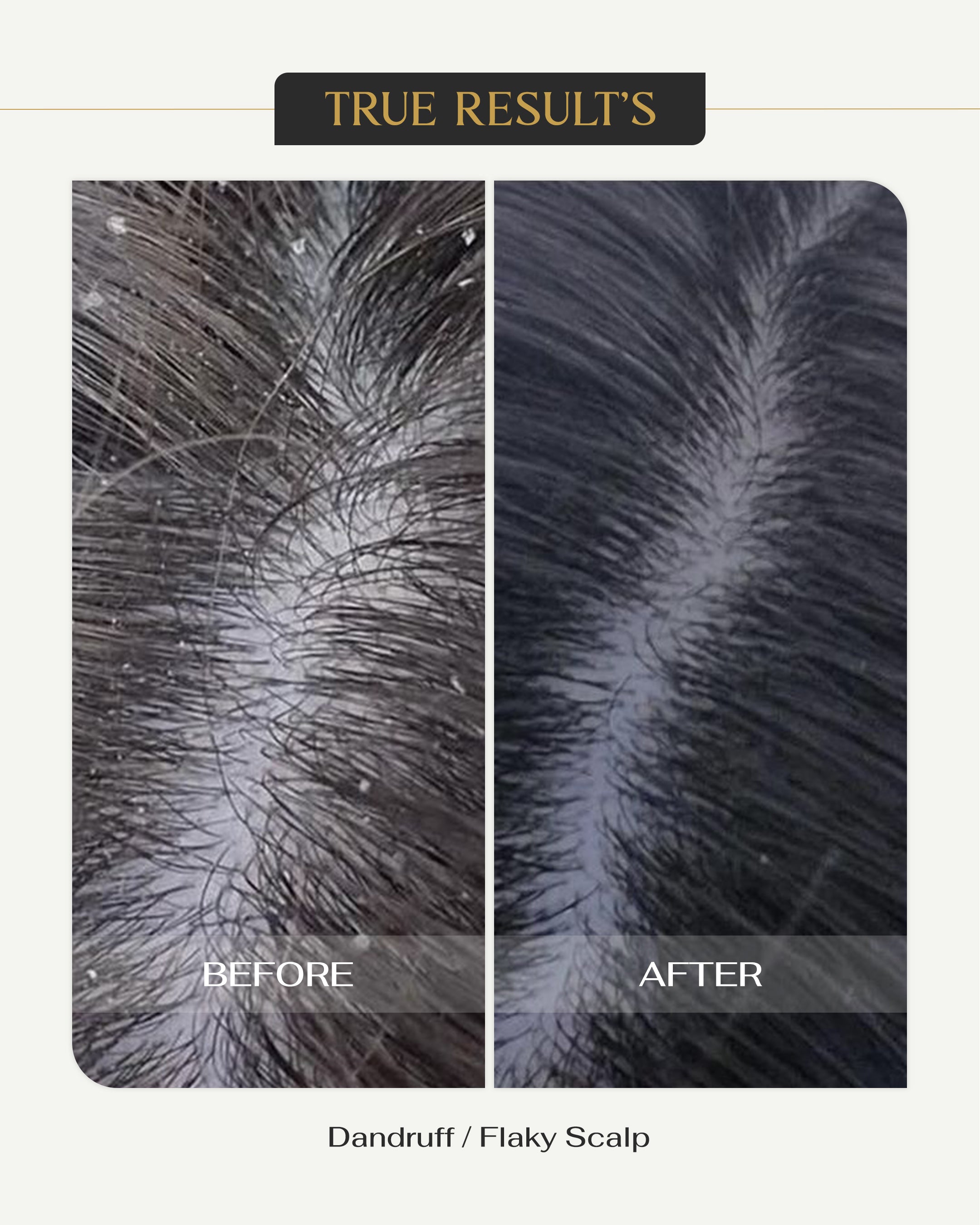 Scalp Clarify Hair Serum