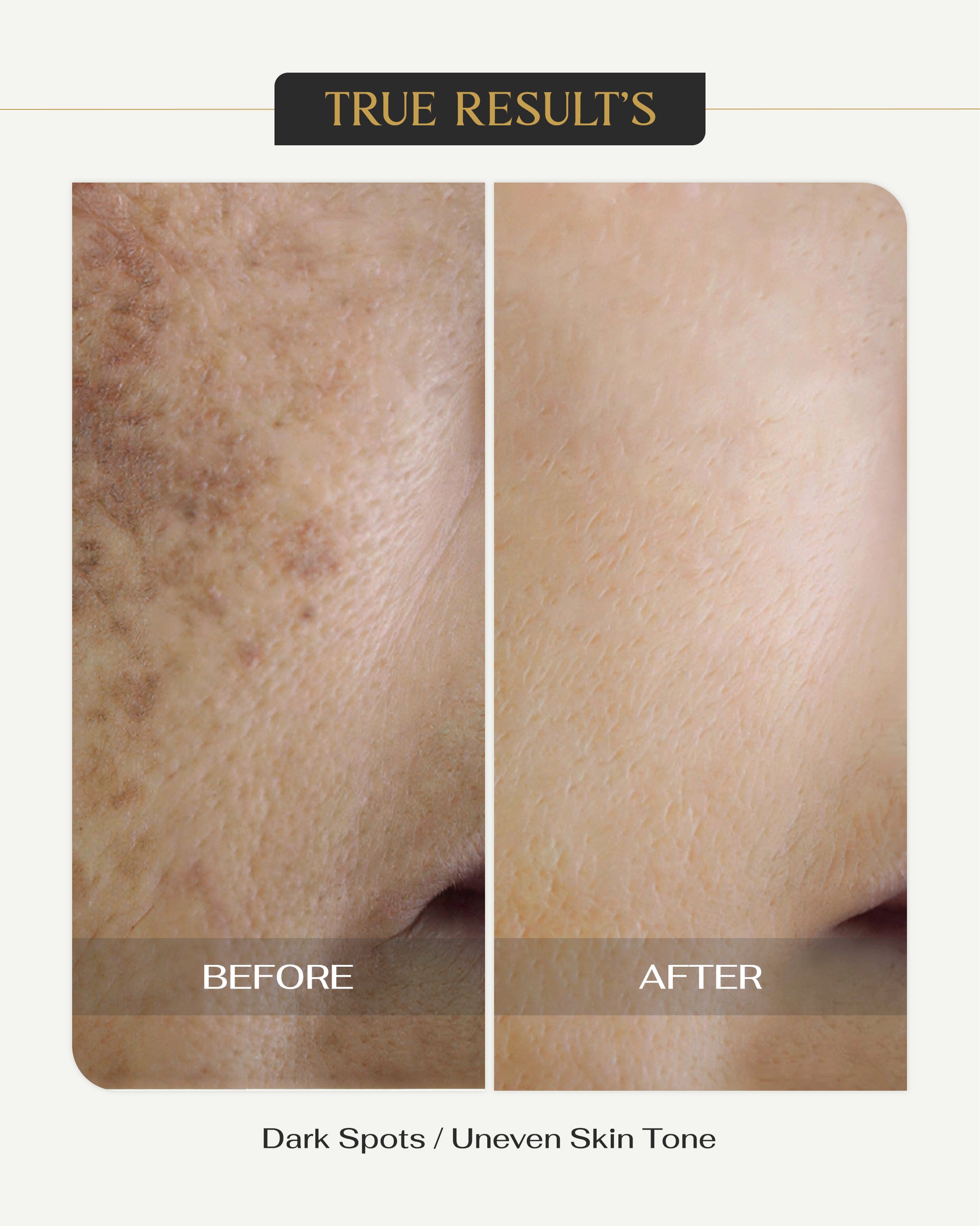 Pigmantation Face Serum