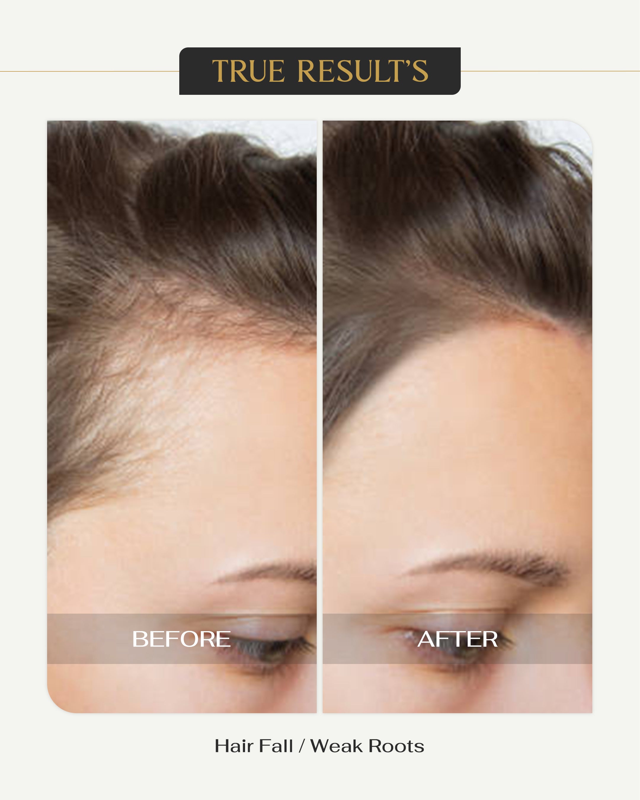 Root Revive Hair Serum